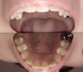 歯のイメージ